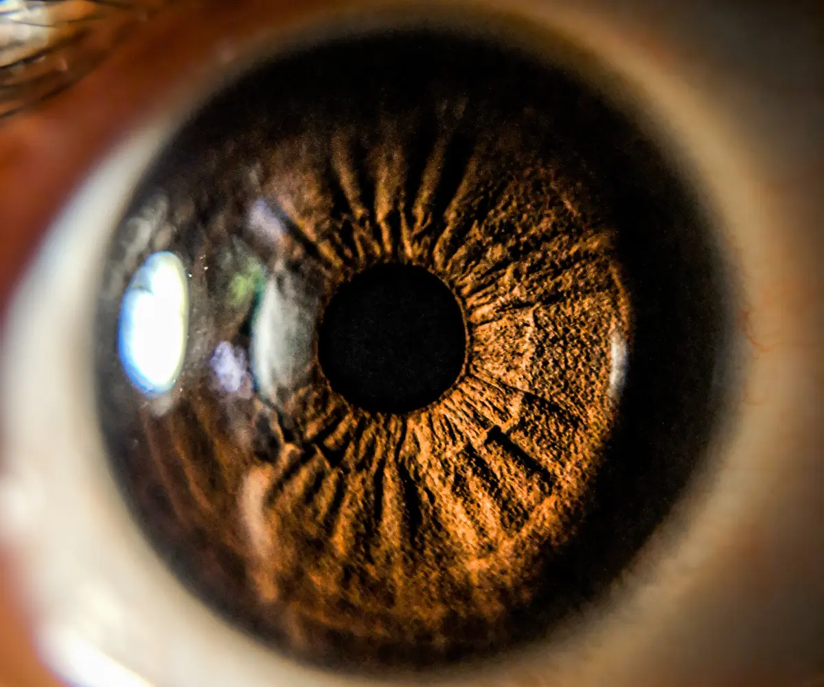 Retina de ojo