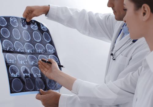 Esclerosis múltiple y medicina regenerativa: Una nueva esperanza para el futuro