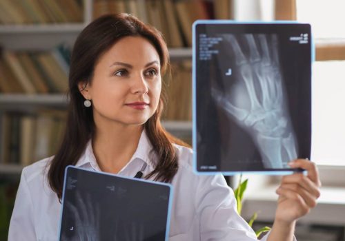 tratamiento-para-artrosis